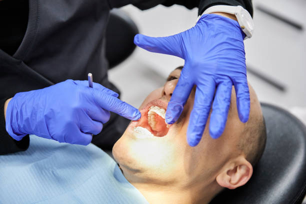 Best Emergency Tooth Extraction in Whitefish, MT
